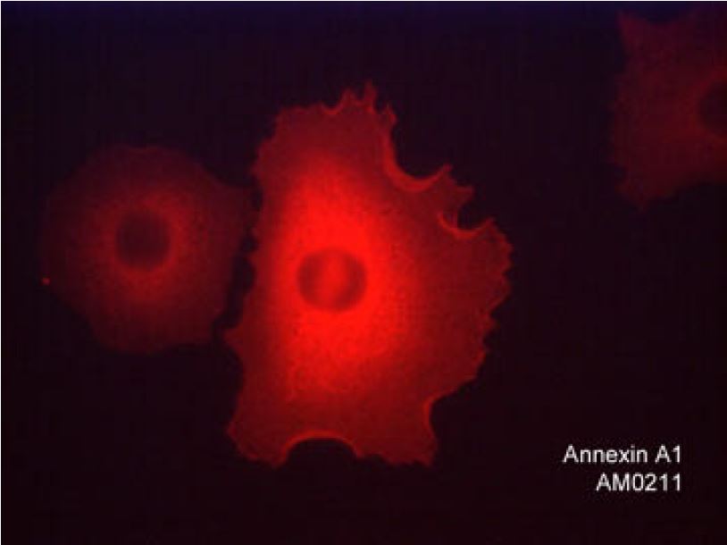 抗Annexin A1抗体を用いたヒトA549細胞の免疫蛍光染色像