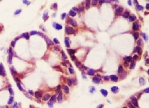 抗MLKL抗体免疫組織染色（IHC-P）イメージ