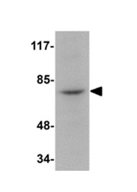 抗RIPK1/RIP1抗体ウエスタンブロット（West）イメージ