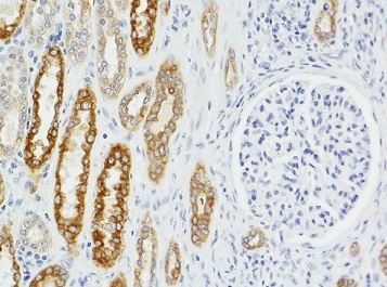 ヒト腎臓連続切片の免疫組織染色像