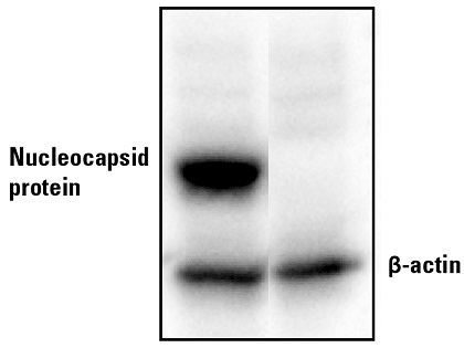 Nucleocapsid_mRNA2