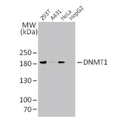 Anti-DNMT3B antibody（#GTX129127）を用いた免疫組織染色像
