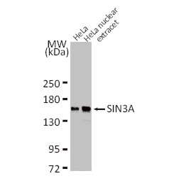 Anti-TET1 antibody [GT1462]（#GTX627420）を用いたウエスタンブロッティング像