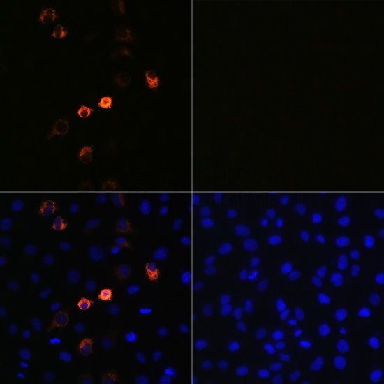 抗SARS-CoV-2 Spike抗体を用いた免疫蛍光染色像