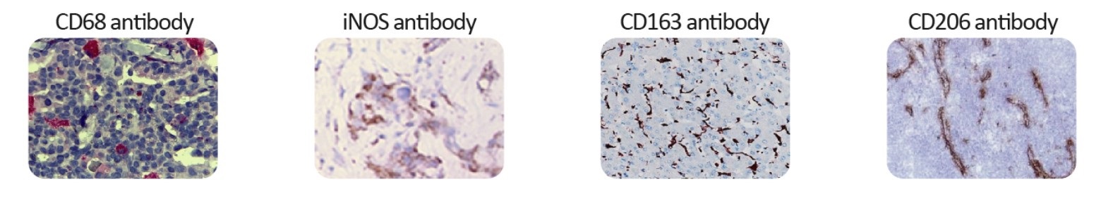 M1/M2/TAM Marker Antibody Panelの使用例
