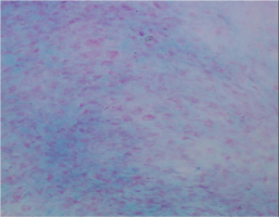 軟骨細胞Alcian Blue染色