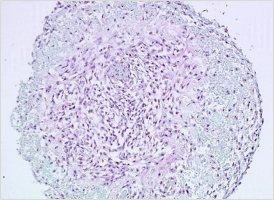 軟骨細胞Safranin O染色