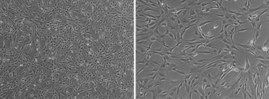 ヒト初代培養細胞（Angio-Proteomie社）            Human Pirmary Cells