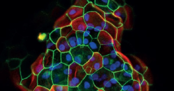Cultrex RGF BMEtype を使用したオルガノイドの肝細胞への分化