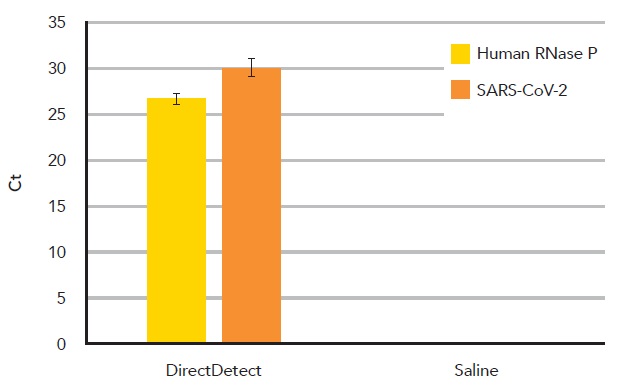 SARS-CoV-2の検出の比較