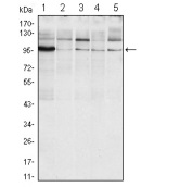 抗IRE1マウスモノクローナル抗体（#BF0223）を用いたRaji（1）、A431（2）、Jurkat（3）、HeLa（4）、およびHEK293（5）細胞のウエスタンブロット分析