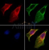 抗リン酸化IRE1（Ser724）抗体（#AF7150、1/200希釈）＋マウス抗β-チューブリン抗体(#T0023、1/200)、およびAlexa Fluor 594標識ヤギ抗ウサギIgG(H+L)抗体（赤）とAlexa Fluor 488標識ヤギ抗マウスIgG(H+L)抗体（緑）、DAPI（核、青）を用いたHeLa細胞の免疫蛍光染色像