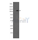 抗リン酸化IRE1（Ser724）抗体（#DF8322）を用いたHT29細胞ライセート中のリン酸化IRE1（phospho S724）のウエスタンブロット分析