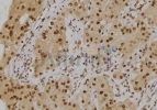 抗リン酸化IRE1（Tyr628）抗体（#AF7151、1/100希釈）＋HRP標識ヤギ抗ウサギIgG抗体を用いたヒト腎臓組織パラフィン包埋切片の免疫組織染色像