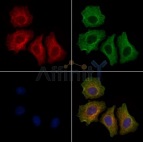 抗リン酸化IRE1（Tyr628）抗体（#AF7151、1/200希釈）＋マウス抗β-チューブリン抗体(#TT0023、1/200)、およびAlexa Fluor 594標識ヤギ抗ウサギIgG(H+L)抗体（赤）とAlexa Fluor 488標識ヤギ抗マウスIgG(H+L)抗体（緑）、DAPI（核、青）を用いたHepG2細胞（LPSを4時間処理）の免疫蛍光染色像