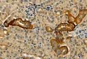 抗IRE1抗体（#DF7709、1/100希釈）＋HRP標識抗ウサギIgG抗体を用いたマウス腎臓組織パラフィン包埋切片の免疫組織染色像