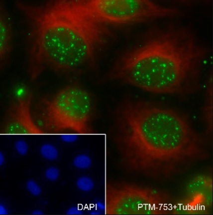 Anti-Phosphol-Histone H2A.X（Ser139）, Mouse-Mono（#PTM-753、1/100倍希釈）を用いたHeLa細胞の蛍光免疫染色像