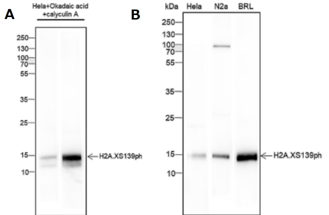 Anti-Pohspho-Histone H2A.X（Ser139）, Mouse-Mono（#PTM-753、1/100倍希釈）を用いたHeLa細胞の蛍光免疫染色像