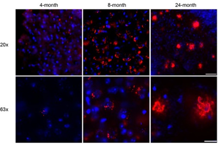 3×Tgマウス（4、8、および24ヶ月齢）の冠状切片におけるAβの免疫蛍光像