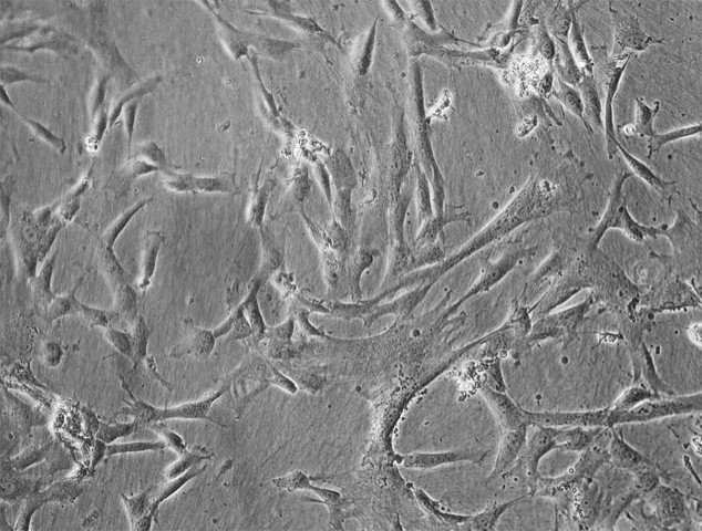 ヒト羊膜由来間葉系幹細胞（hAM-MSC）