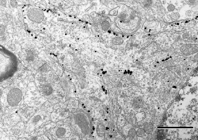 Nanogold-Fab'ヤギ抗ウサギIgG（#2004）＋HQ Slver（#2012）を用いたラット脳のK<sup>+</sup>チャネルKv2.1サブユニットの顕微鏡像