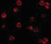 パラフォルムアルデヒド固定HeLa細胞の免疫蛍光染色像