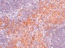 マウス腎臓組織の免疫組織染色像<br>・二次抗体：FITC標識抗ウサギ抗体