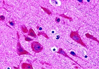 パラフィン包埋ヒト脳ライセートの免疫染色像