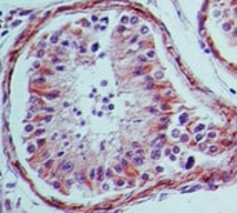 ホルマリン固定パラフィン包埋ヒト睾丸組織の免疫組織染色像