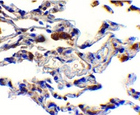 ホルマリン固定パラフィン包埋ヒト肺組織の免疫組織染色像