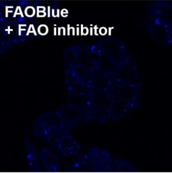 HepG2細胞への使用例（＋FAO inhibitor）