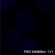 FAOBlueのHepG2細胞での使用例（+Inhibitor）
