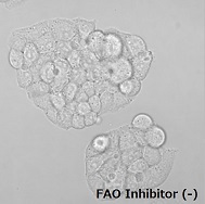 FAOBlueのHepG2細胞での使用例（-Inhibitor）