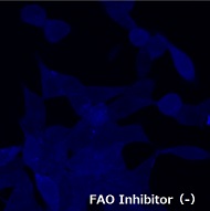 FAOBlueのLNCap細胞での使用例（-Inhibitor）