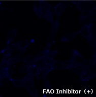 FAOBlueのLNCap細胞での使用例（+Inhibitor）