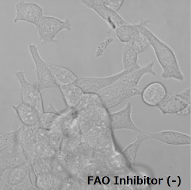 FAOBlueのLNCap細胞の細胞での使用例（-Inhibitor）