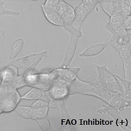 FAOBlueのLNCap細胞の細胞での使用例（+Inhibitor）