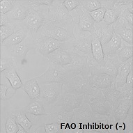 FAOBlueのHeLa細胞での使用例（-Inhibitor）