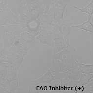 FAOBlueのHeLa細胞での使用例（+Inhibitor）