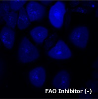 FAOBlueのA549細胞での使用例（-Inhibitor）