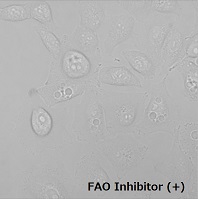 FAOBlueのA549細胞での使用例（+Inhibitor）
