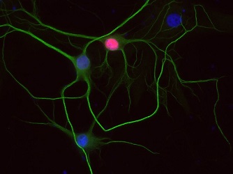 PFA固定パラフィン包埋ラット海馬ニューロンの免疫細胞染色像