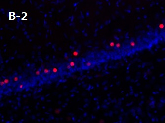 PFA固定パラフィン包埋ラット海馬切片の免疫組織染色像