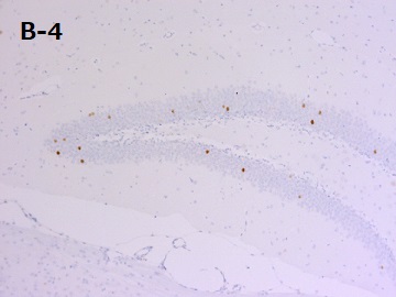PFA固定パラフィン包埋マウス海馬切片の免疫組織染色像
