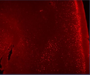 皮質を含むマウス脳の矢状断面のiDISCOによる光学的透明化後の免疫組織染色像