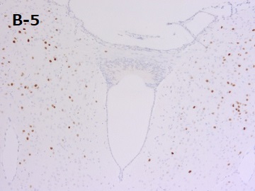 PFA固定パラフィン包埋マウス脳切片の免疫組織染色像