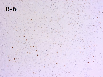 PFA固定パラフィン包埋マウス皮質切片の免疫組織染色像