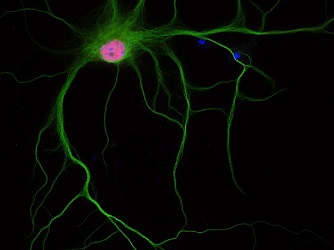 PFA固定パラフィン包埋ラット海馬ニューロンの免疫染色像