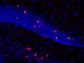 PFA固定パラフィン包埋マウス海馬切片の免疫染色像