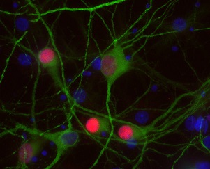 PFA固定パラフィン包埋ラット海馬ニューロンの免疫染色像